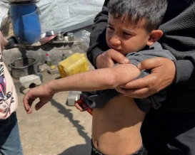 أكثر من مليوني فلسطيني يواجهون فصل الصيف في ظروف كارثية