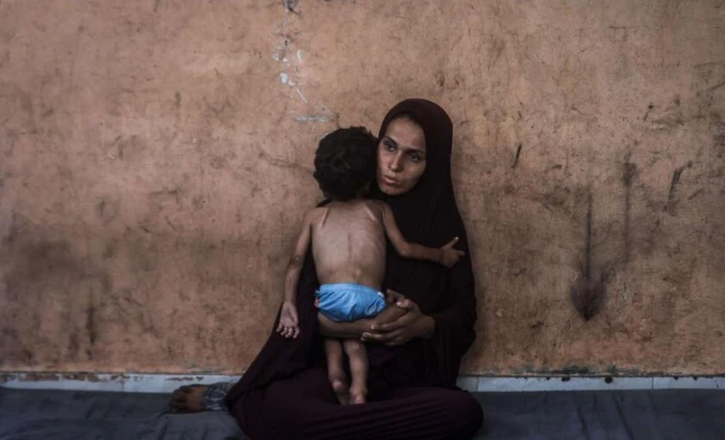 غزة على أعتاب كارثة صحيّة وبيئية تهدد حياة الأطفال والنساء